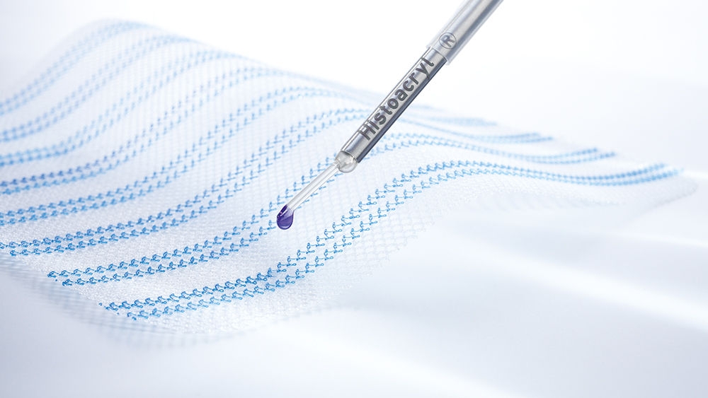 Kirurgisk nett med Histoacryl® LapFix applikator for nettfiksering